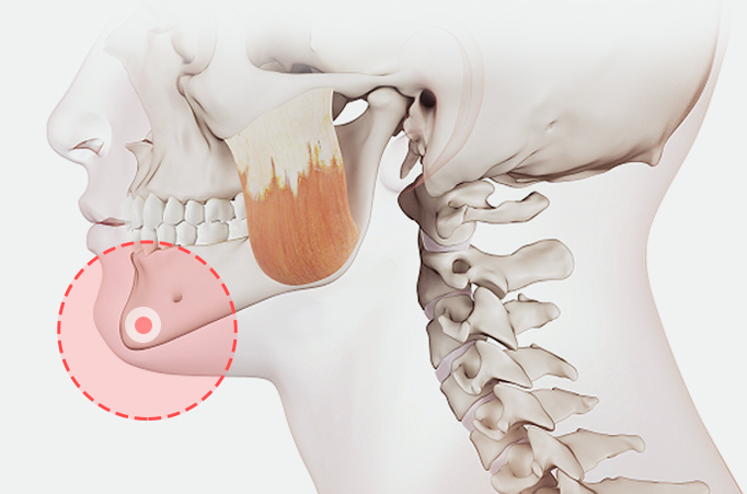 Things to Know About Contouring Surgery and Precautions image 2