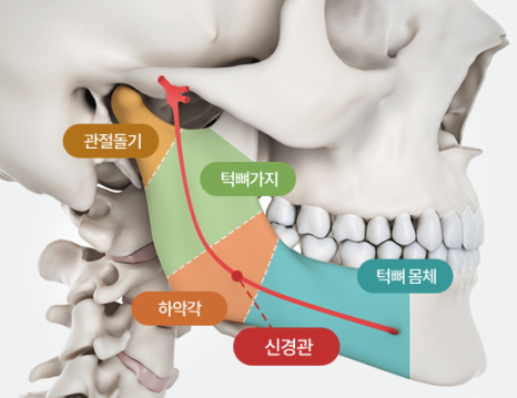 What Are the Causes of a Square Jaw, and How Can It Be Improved? image 2