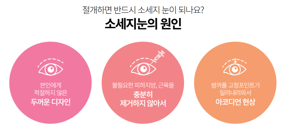 자연스러운 절개쌍꺼풀 수술: 자연미를 고려한 수술 방법 관련 이미지 2
