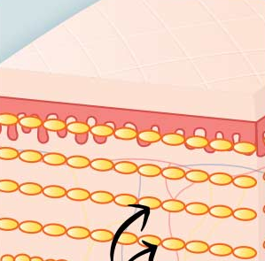 PureCell Fat Grafting: Fat Refinement and Grafting Techniques image 6