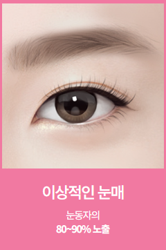 눈재수술 시 눈매교정이 꼭 필요할까? 관련 이미지 4