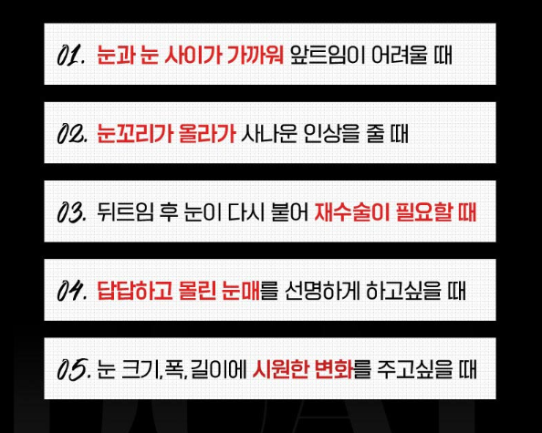 뒷트임, 밑트임, 눈트임 수술로 자연스러운 눈매 교정 관련 이미지 1