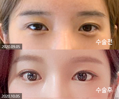 듀얼트임(뒤밑트임)이 효과적인 케이스는? 관련 이미지 8
