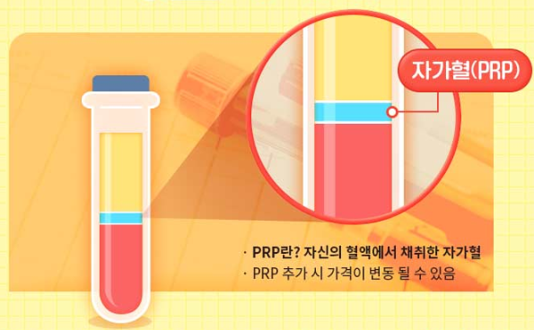 퓨어셀 지방이식이 얼굴 윤곽에 어떻게 도움이 될 수 있는지 알아보세요! 관련 이미지 2