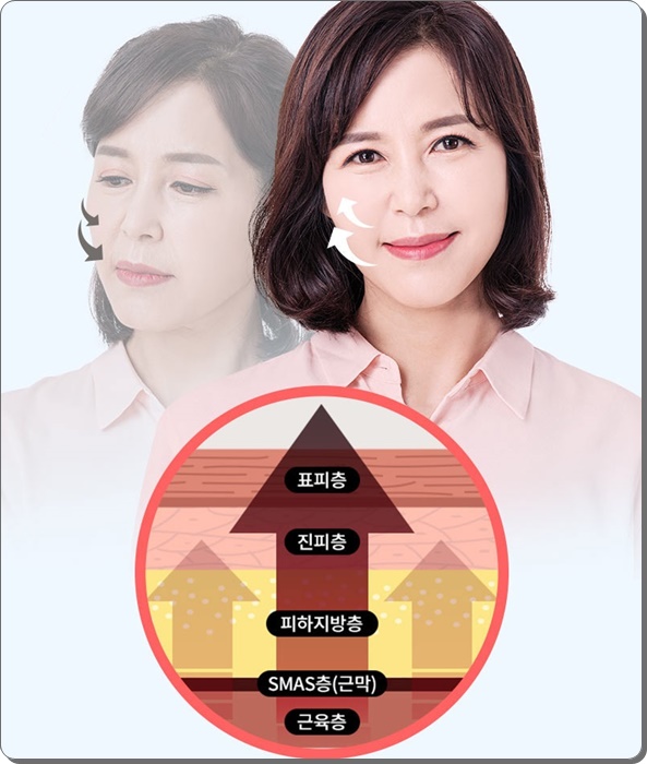 안면거상술의 비밀 그리고 안면거상 할 때 유의할 점이라면 관련 이미지 10