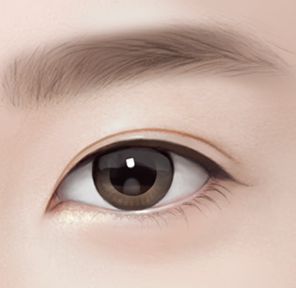 Rhinoplasty? No, Eye Surgery: The Right Approach for a Natural Result image 1