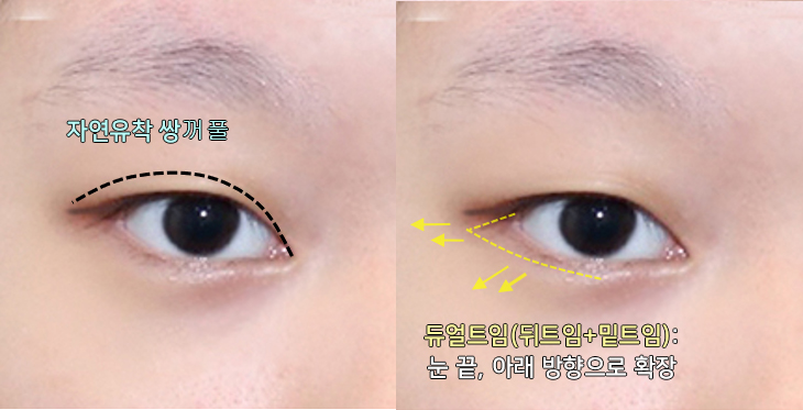 듀얼트임(뒤밑트임)이 효과적인 케이스는? 관련 이미지 4
