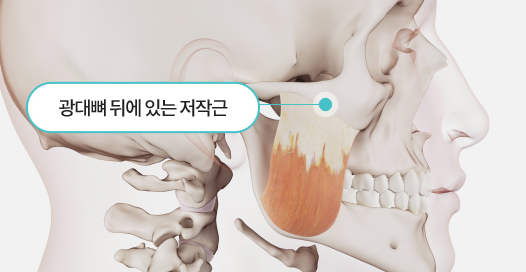 자연스러운 얼굴 라인을 위한 안전한 얼굴 윤곽 개선 방법 관련 이미지 4
