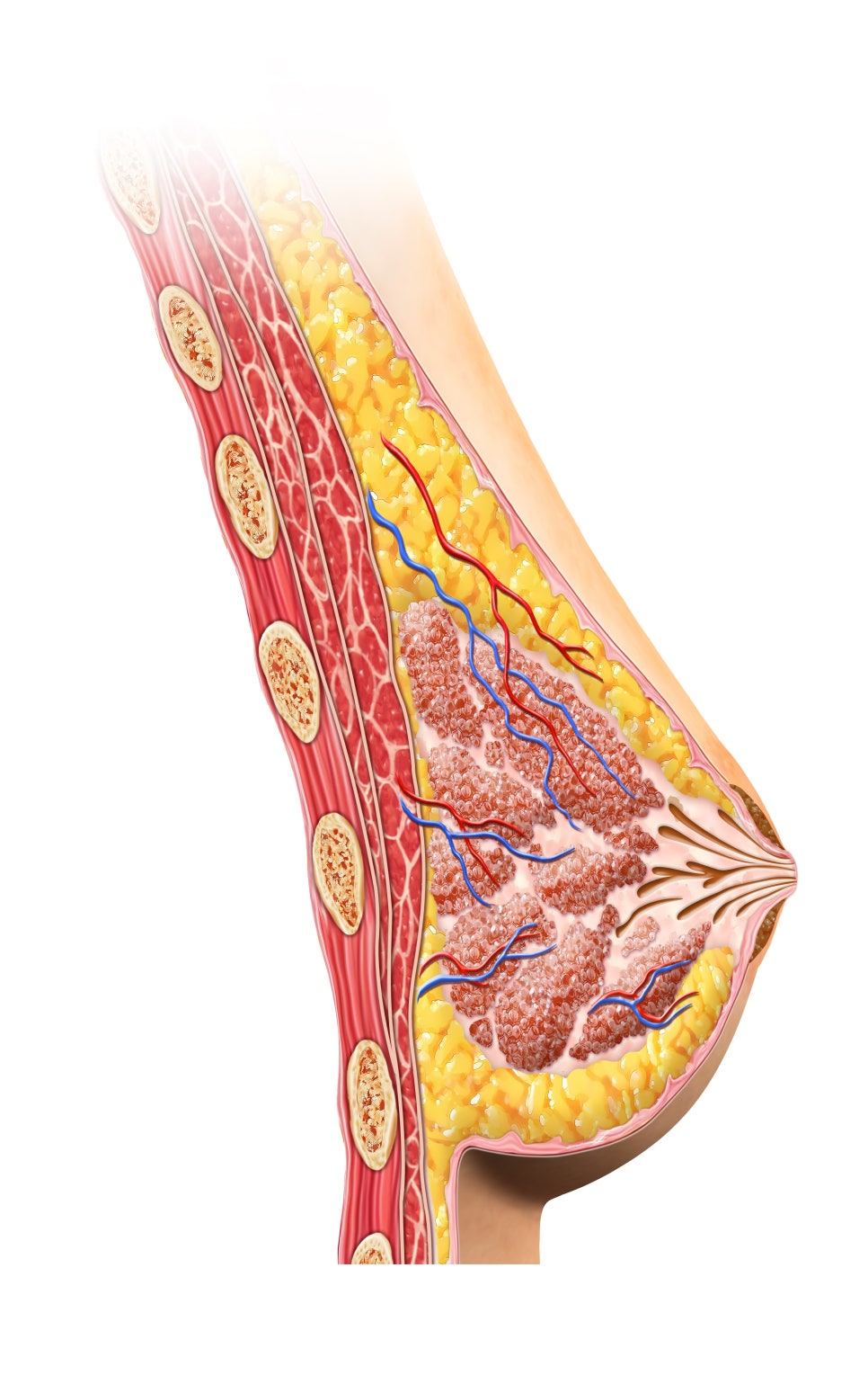 In Which Cases Can Sagging Breasts Be Improved with Implants Alone? image 1