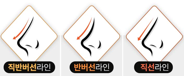 What to Consider for Your First Nose Surgery for a Natural Result image 1