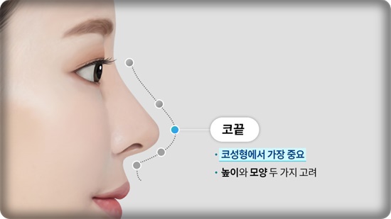 코성형, 얼굴 균형을 고려한 5가지 핵심 포인트 관련 이미지 3