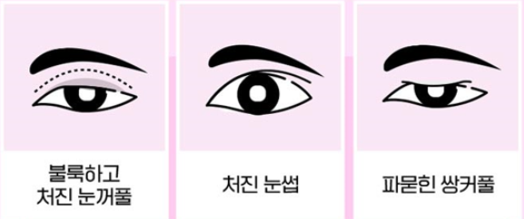 Explore Various Ways to Improve a Drooping Forehead image 1