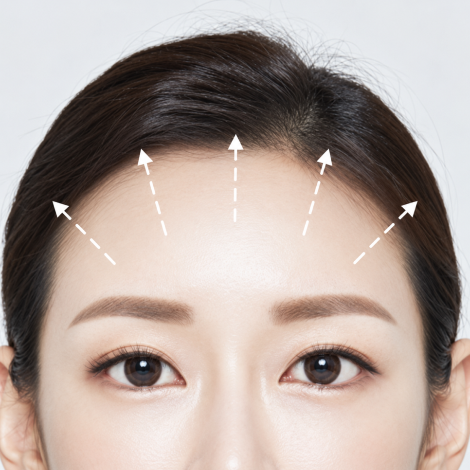 눈성형, 쌍꺼풀 수술 같은 라인도 다르게 보이는 이유는? 관련 이미지 3