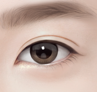 What Should You Check Before Undergoing a Non-Incisional Double Eyelid Surgery? image 3