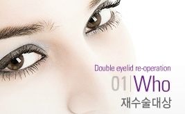 [Duhan Plastic Surgery Double Eyelid Surgery] - [Ptosis Correction Revision Surgery] image 3