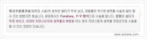 [두한성형외과 경쟁력 눈성형] - [몽고주름 제거수술, 앞트임 수술 안내] 관련 이미지 5