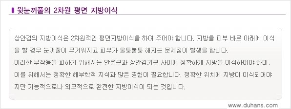 [두한성형외과 NO.1 눈성형] - [함몰된(꺼진) 눈꺼풀에서 쌍꺼풀 라인 교정 4.] 관련 이미지 5