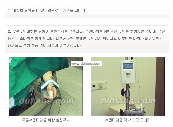 [두한성형외과 경쟁력 미세지방이식] - [부드럽고 아름다운 얼굴선 얼굴 미세지방이식 과정] 관련 이미지 2