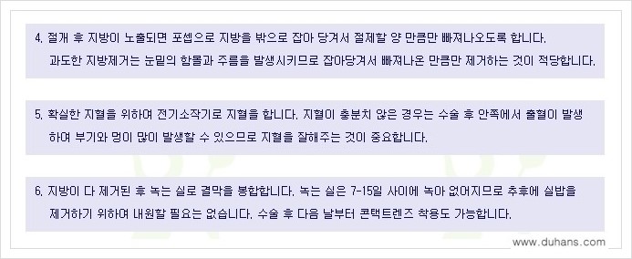 [두한성형외과 경쟁력 지방제거] - [윗눈꺼풀 지방제거, 아랫 눈꺼풀 지방제거  안내 2.] 관련 이미지 6