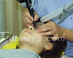 Duhan Plastic Surgery Laser Treatment - Mole Removal, Spot Removal, Melasma, Blemishes, Hyperpigmentation, Skin Tone Improvement, Elasticity Improvement, Skin Texture Improvement image 20