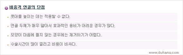 [두한성형외과 경쟁력 코성형] - [여러 가지 코성형 방법 안내] 관련 이미지 7