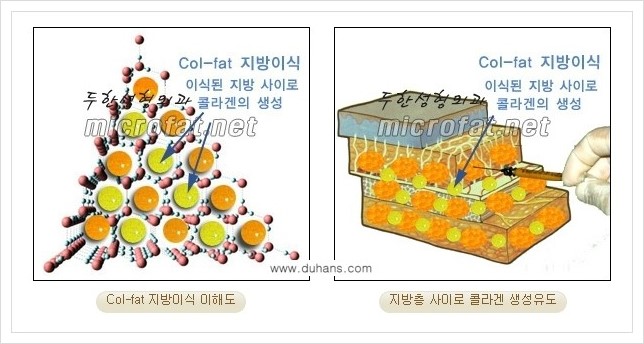​﻿[두한성형외과 경쟁력 눈밑성형] - [눈밑 다크써클 개선 방법] 관련 이미지 4