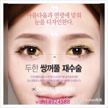 [Duhan Plastic Surgery Double Eyelid Revision Surgery] - [Beautiful Double Eyelids] image 19