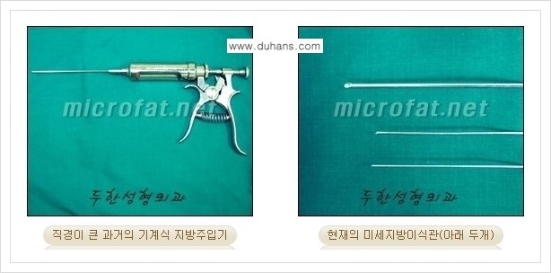 [두한성형외과 경쟁력 미세지방이식] - [두한 미세지방이식 클리닉의 특징 안내] 관련 이미지 14