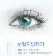 [두한성형외과 NO.1 눈성형] - [상안검 수술에 대한 정보] 관련 이미지 9