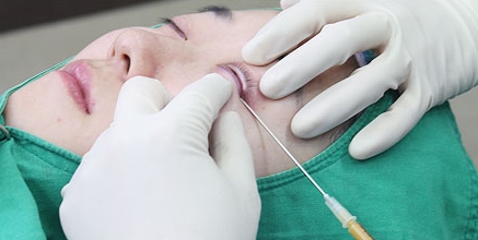 [Duhan Plastic Surgery Eye Area Surgery] - [Dark Circles and Aegyo-sal] image 11