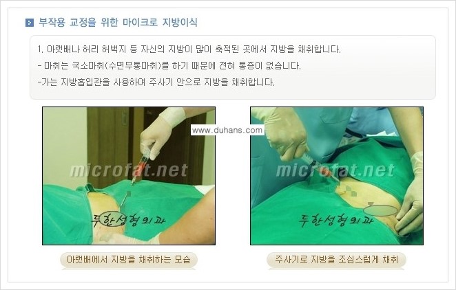 [두한성형외과 경쟁력 지방이식] - [지방이식 부작용 교정 안내 2.] 관련 이미지 5