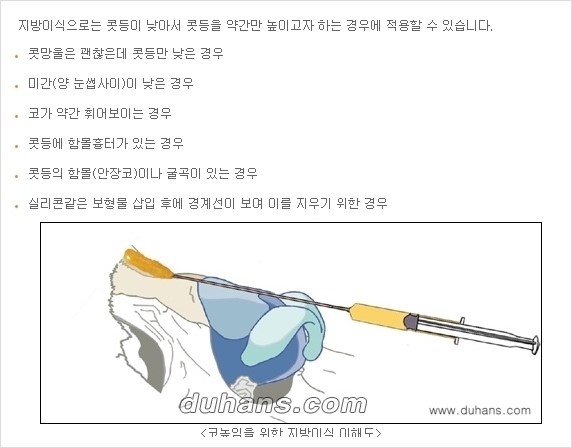[두한성형외과 경쟁력 미세지방이식] - [코 지방이식 2.] 관련 이미지 2