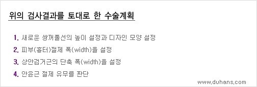 [두한성형외과 경쟁력 쌍꺼풀 재수술, 극한 눈재수술] - [재수술에 대한 최선의 대안 제시] 관련 이미지 12