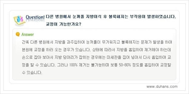 [두한성형외과 경쟁력 쌍꺼풀 재수술, 극한 눈재수술] - [어색한 쌍꺼풀 라인을 교정하는 윗눈꺼풀 미세지방이식] 관련 이미지 10