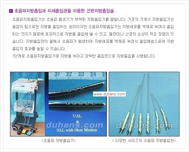 [두한성형외과 경쟁력 지방흡입] - [초음파 간편지방흡입 안내 ①] 관련 이미지 2