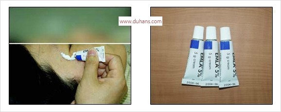 [두한성형외과 안전 제일 성형] - [통증 없는 마취 - 무통 수면마취] 관련 이미지 4