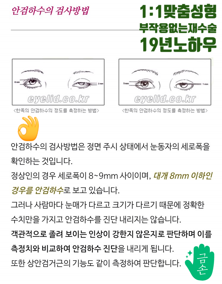 [두한성형외과 눈재수술] - [안검하수] 관련 이미지 20