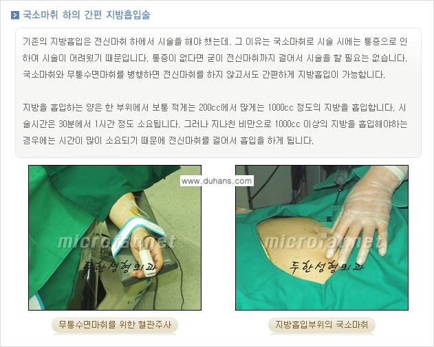 [두한성형외과 간편 지방흡입] - [복부(뱃살) 지방흡입 안내 ①] 관련 이미지 4