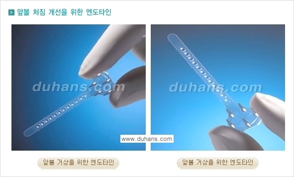 [두한성형외과 경쟁력 주름성형] - [볼처짐 개선, 이마주름 개선을 위한 엔도타인 리프팅 안내] 관련 이미지 6