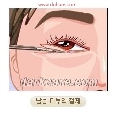 [두한성형외과 경쟁력 안검성형] - [젊어 보이면서 개선된 인상을 주기 위한 성형] 관련 이미지 7