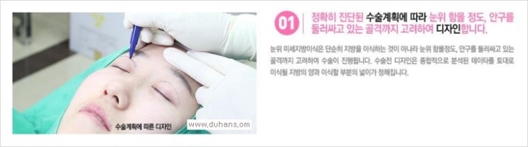 [두한성형외과 경쟁력 눈밑 다크써클 치료] - [눈밑 다크써클과 눈위 지방이식 콤비 프로그램 안내] 관련 이미지 5