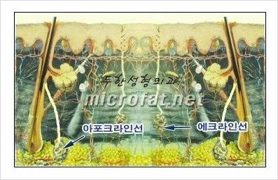 [두한성형외과 경쟁력 액취증 치료] - [참기 힘든 겨드랑이 냄새 액취증, 암내 치료] 관련 이미지 3