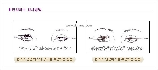 [두한성형외과 경쟁력 쌍꺼풀 재수술(극한 재수술)] - [안검하수(졸리운 눈매) 교정 안내 1.] 관련 이미지 17