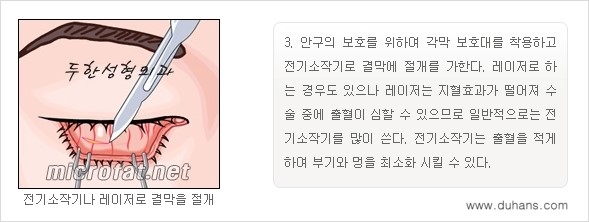 [두한성형외과 경쟁력 "지방제거"] - [눈 지방제거 1.] 관련 이미지 8