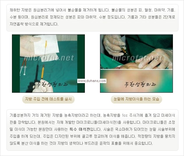 [두한성형외과 경쟁력 눈밑성형] - [눈밑 다크써클과 눈밑 애교살과의 관계] 관련 이미지 5