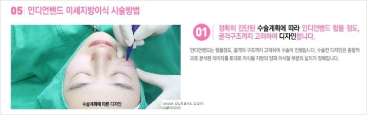 [두한성형외과 경쟁력 눈밑성형] - [눈밑 다크써클 치료 - 다크써클 + 인디언밴드 콤비 프로그램] 관련 이미지 2