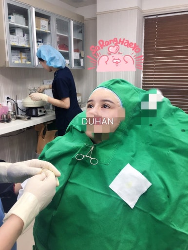 [두한성형외과 쌍커풀재수술] - [개인의 눈매와 특성에 맞는 쌍커풀재수술] 관련 이미지 3