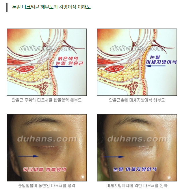 눈밑 다크써클 개선 원리 관련 이미지 9