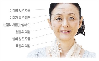[Duhan Plastic Surgery Wrinkle Improvement] - [Wrinkle Lifting] image 10