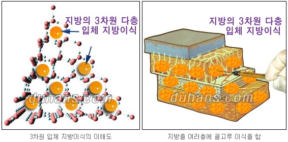 [Duhan Plastic Surgery Facial Autologous Fat Grafting] - [Fat Grafting Guide] image 14